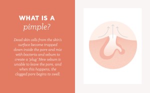 Popping Pimples Problems: What-is-a-pimple?