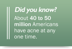 acne-stats-did-you-know