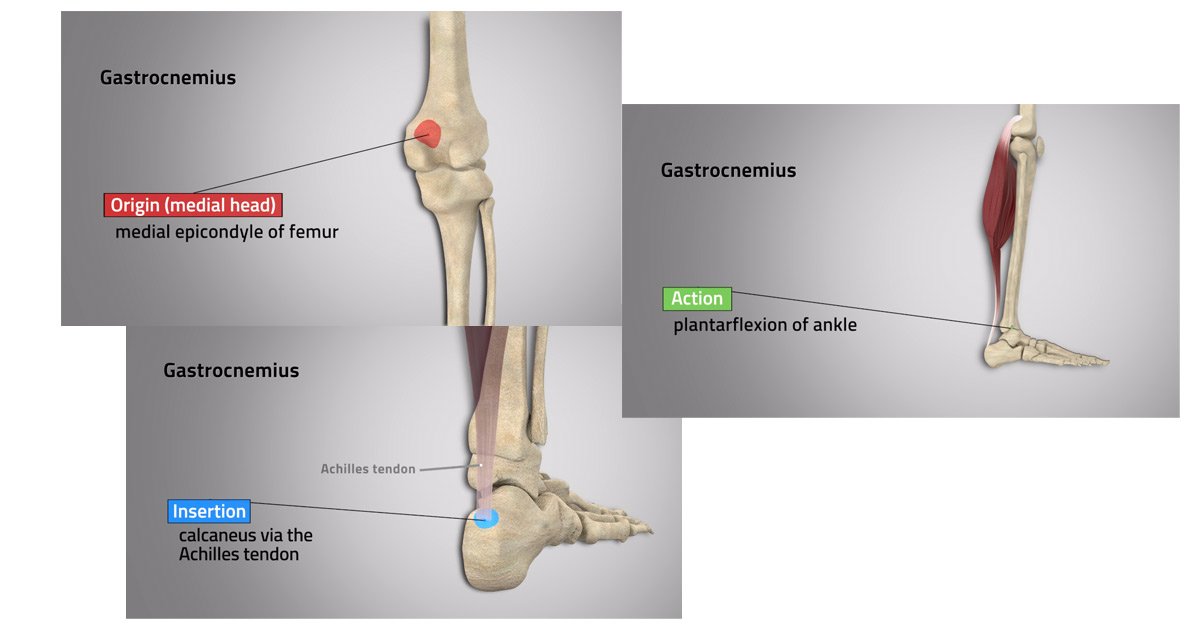 Semitendinosus lies superficial to semimembranosus and forms its . Origins Of Thigh Tendons - Muscles Of The Posterior Thigh Hamstrings Geeky Medics - It can cause