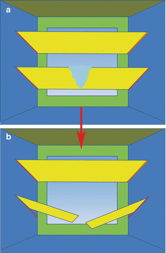 Pelvic Floor Anatomy | Abdominal Key