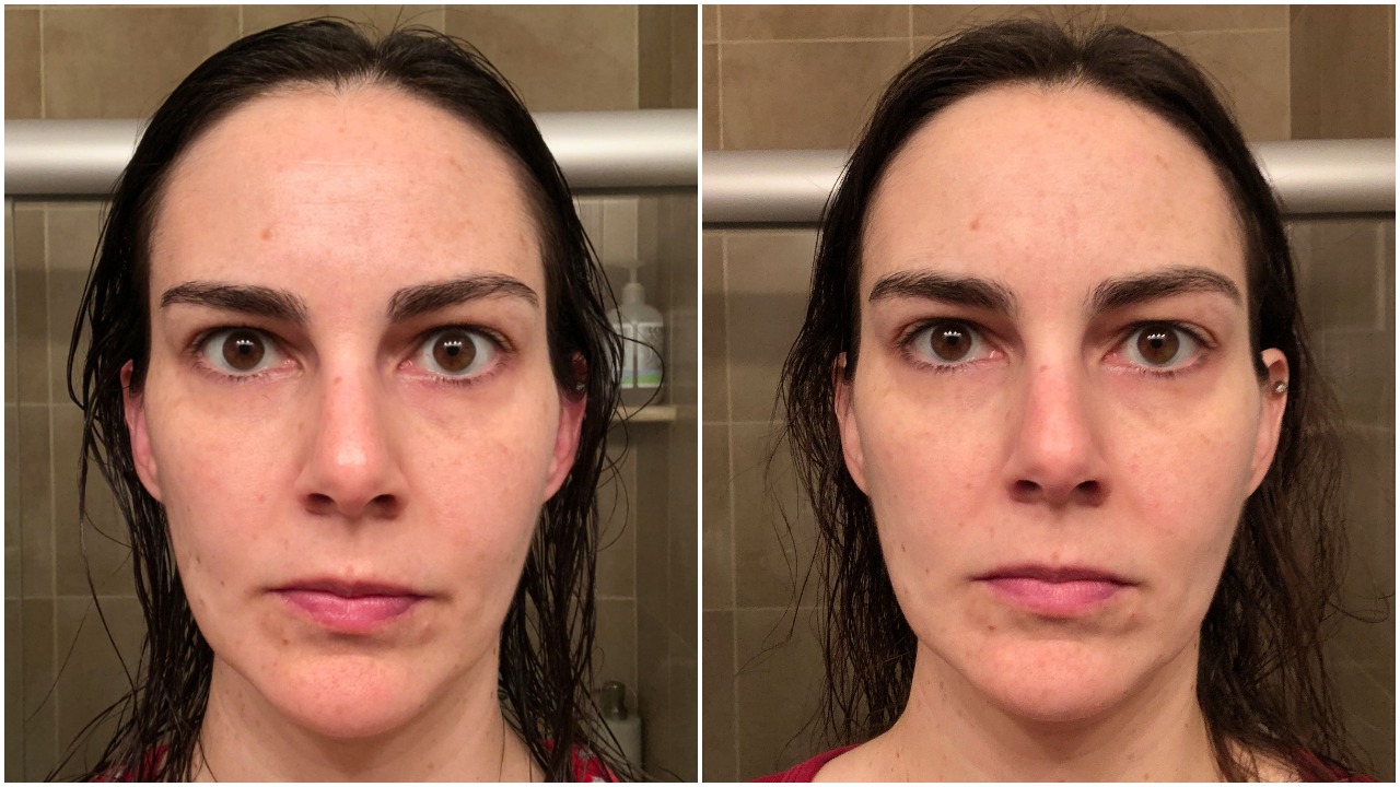 Skin Care Experiment 3Month Update Adventures of Herman