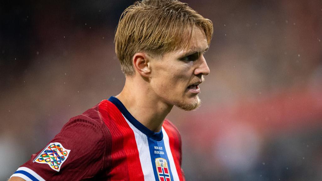 Martin Odegaard Cedera, Mikel Arteta Ungkap Kondisinya