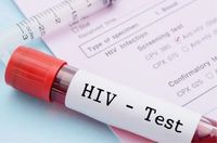 Kini Tes HIV/AIDS Bisa Dicek Sendiri dengan Mudah di Rumah