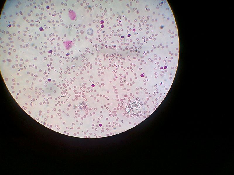 Leukosit Adalah (Pengertian, Jenis, Cara Menurunkan, dan Obat Ampuh Untuk  Anak