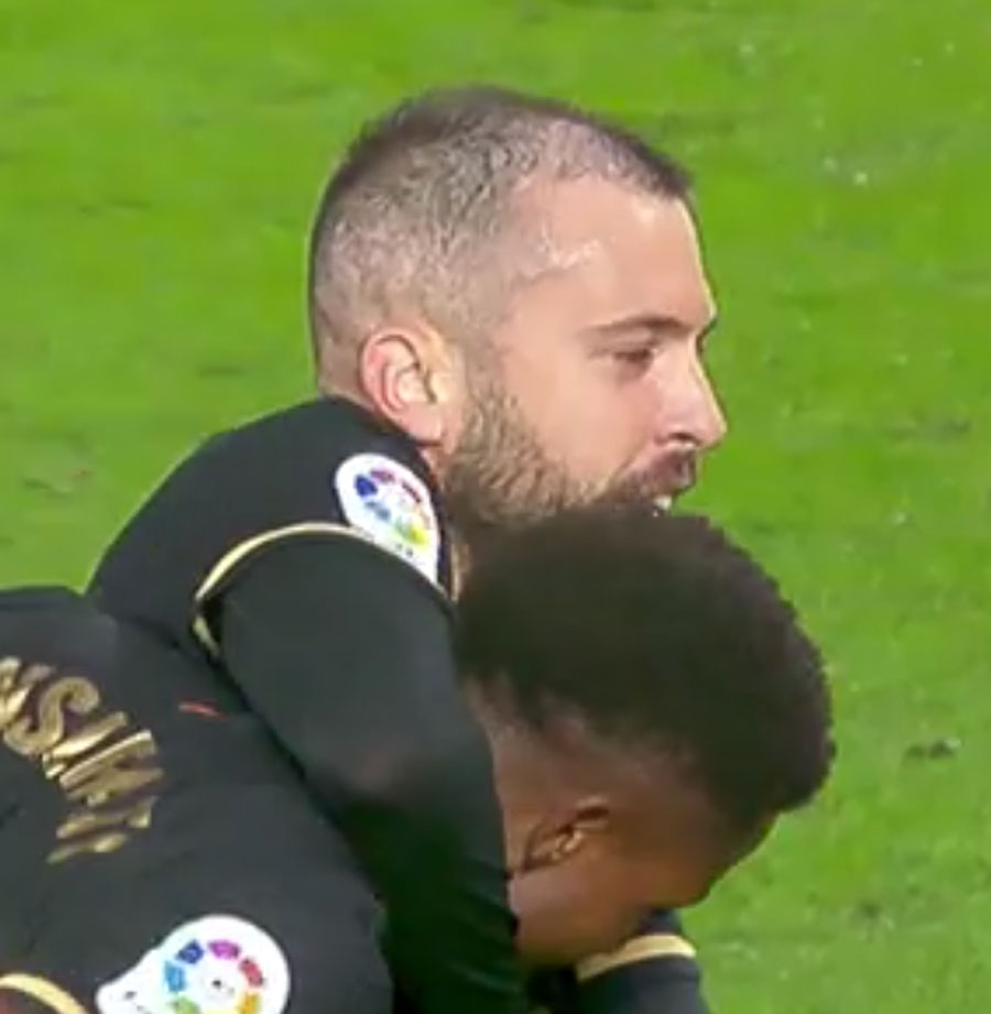 Celta de vigo gegen fc barcelona: Â¿QuÃ© le pasa a Jordi Alba en el pelo? - aMENzing