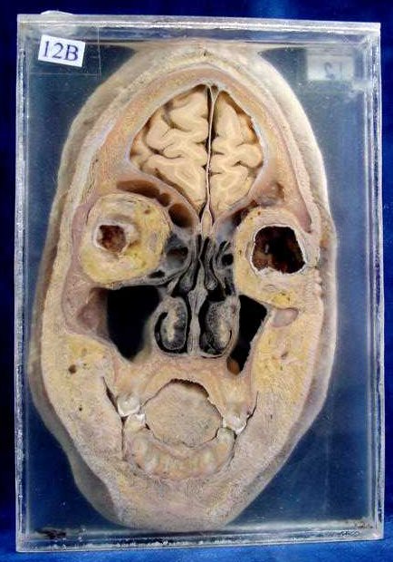 Se o aluno desejar receber o certificado é necessário pagar uma taxa pelo sistema de verificação de identidade. Neupatimagem-UNICAMP