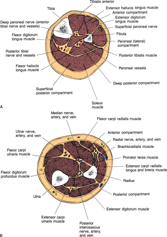 Acute Compartment Syndrome Anesthesia Key