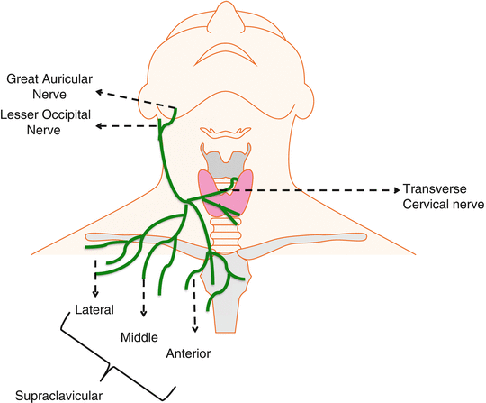 Regional Anaesthesia in the Intensive Care Unit | Anesthesia Key