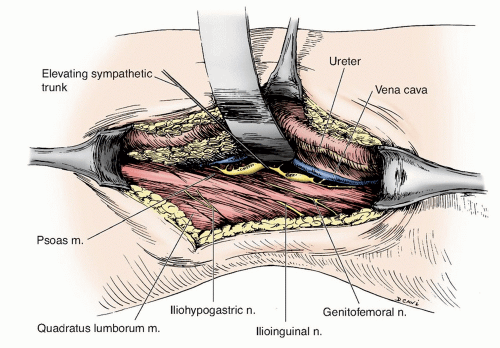 Surgery of the Peripheral Nervous System as a Treatment for Pain ...