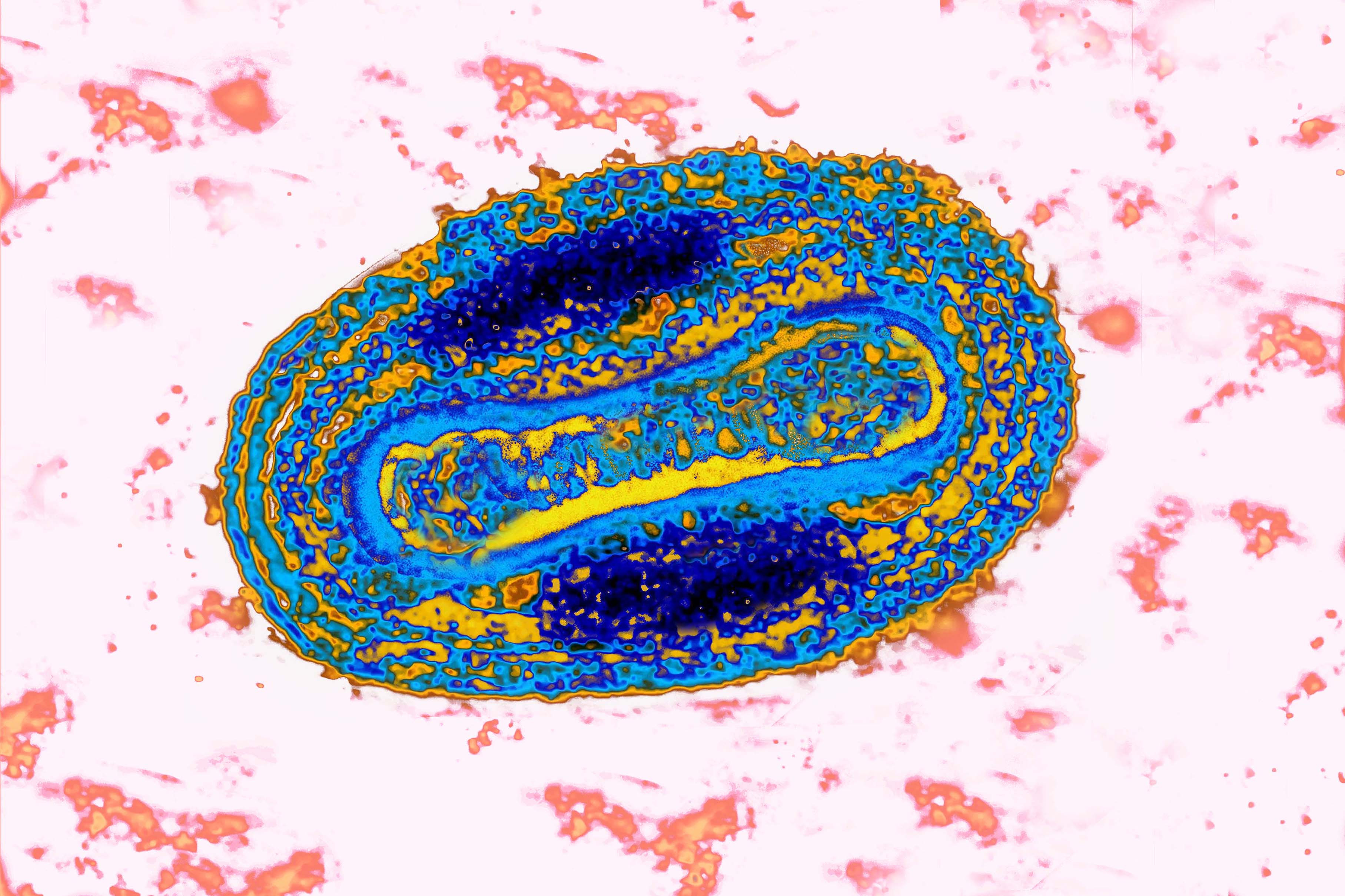 picture Cure For Smallpox 2