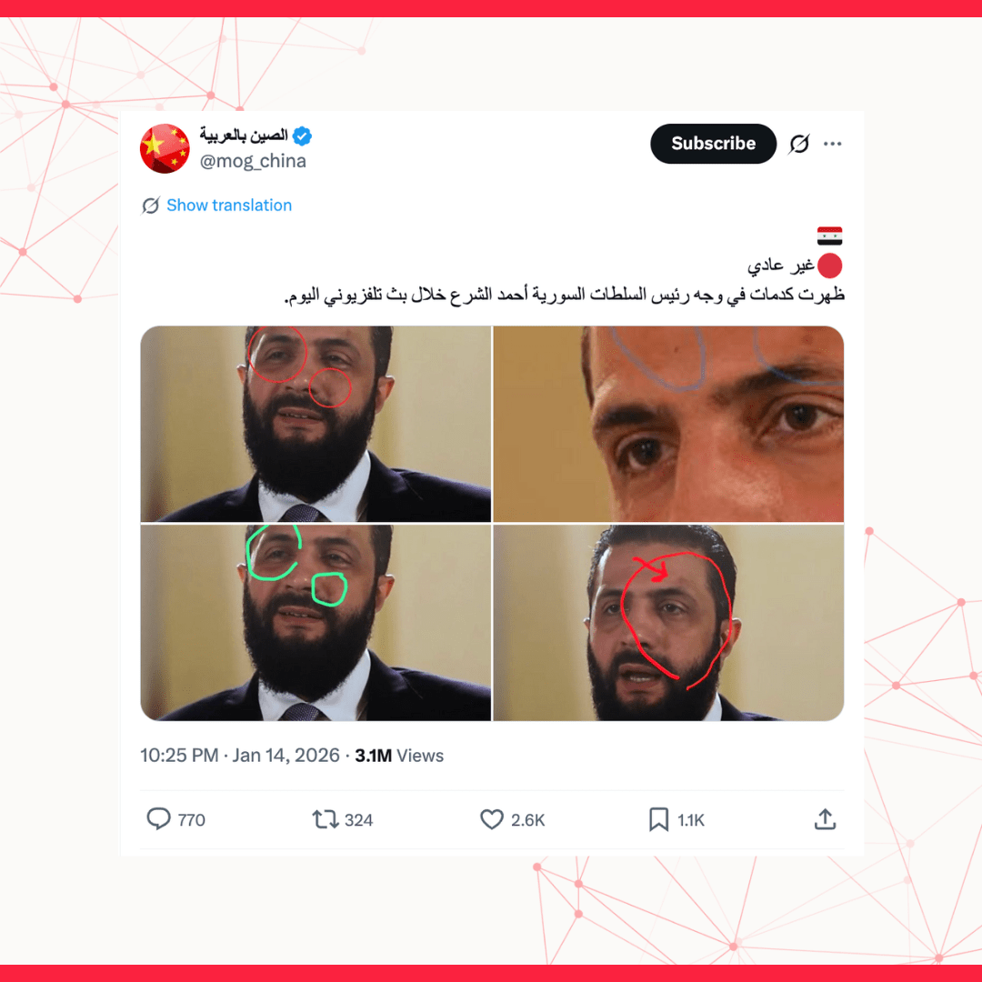 لا صحة لادعاءات ظهور كدمات على وجه أحمد الشرع خلال مقابلته مع قناة 