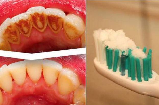 Come Togliere I Baffetti Con Il Dentifricio