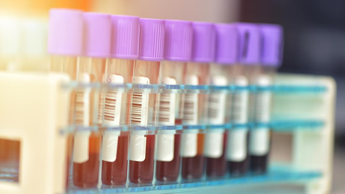 Kenapa Penamaan Virus Mpox Pakai Istilah ‘Clade’? Ini Penjelasan Ilmiahnya