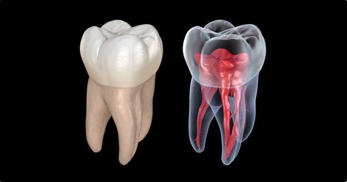 Root canal treatment costs from $700 up to $2,100 Is root canal covered by insurance