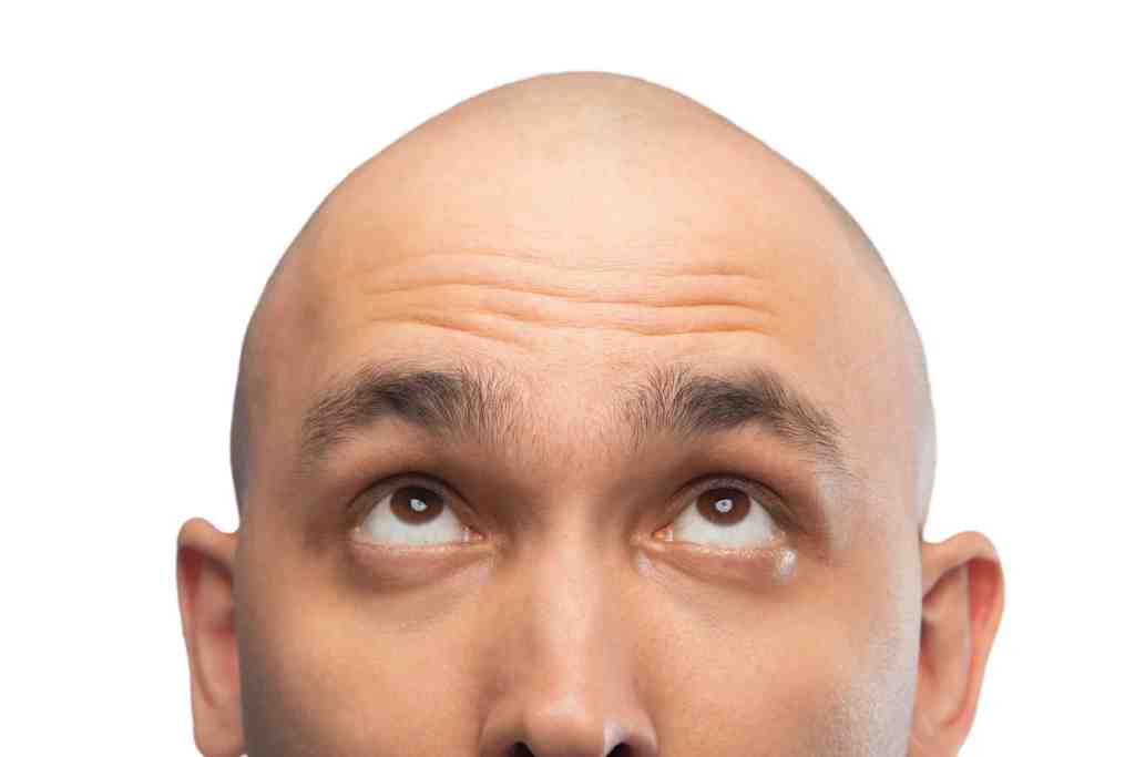Does Shaving Your Head Get Rid Of Lice? Bald Guy Beard