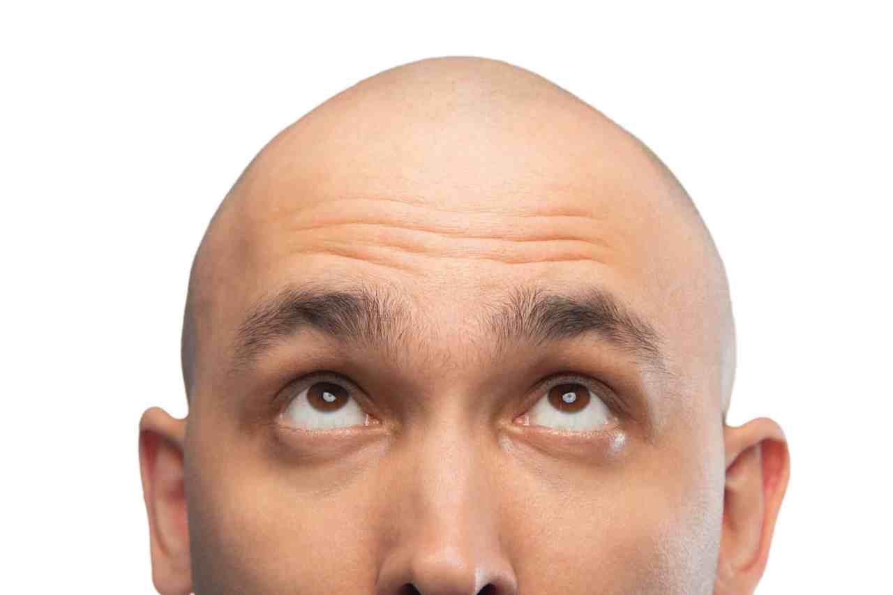 Does Shaving Your Head Get Rid Of Lice? Bald Guy Beard Does Shaving Your Head Get Rid Of Lice? Bald Guy Beard