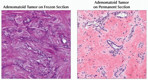 Frozen Section Basicmedical Key