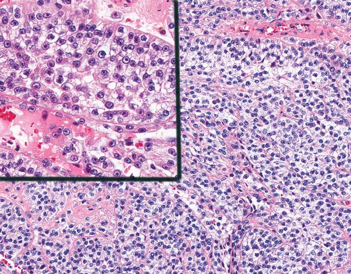 Bone and Soft Tissue Pathology | Basicmedical Key