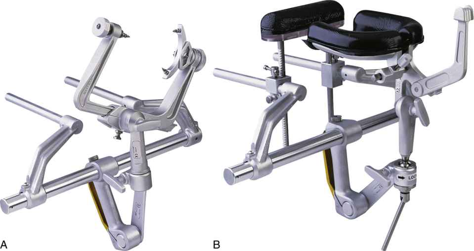 Neurosurgery Basicmedical Key