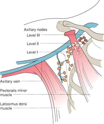 Breast Disease | Basicmedical Key