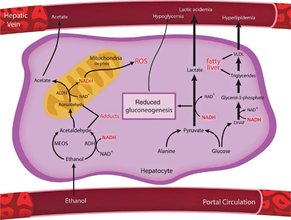 18 Ethanol Metabolism Basicmedical Key