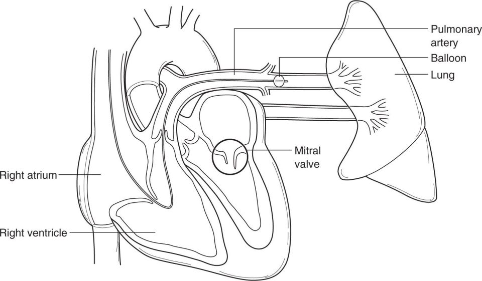 Cardiothoracic Surgery Diseases Of The Heart, Great Vessels, And