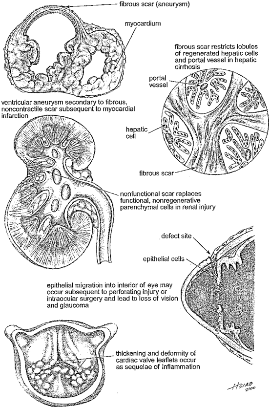The Irreversibility of Organ Injury | Basicmedical Key