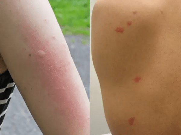 They thrive on your blood and blood from your pets, and they can hide in the tiniest of spots. Do Bed Bug Bites Itch? | 7+ Ways To Relieve Bed Bug Itch