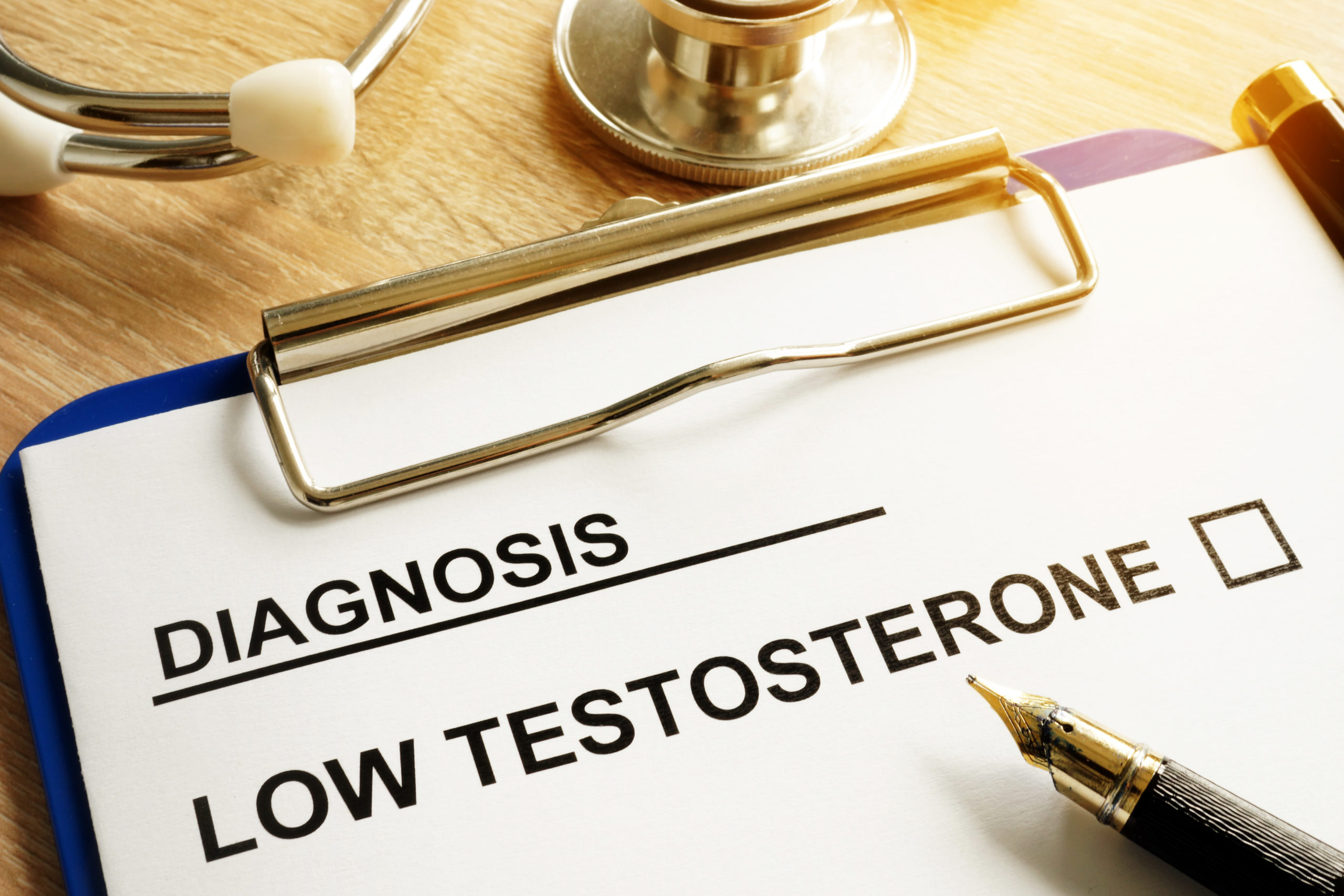Symptoms of low testosterone.  Diagnosis of low testosterone.