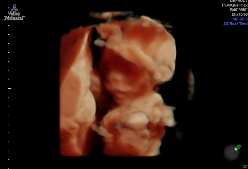 Van Sant Baby #2