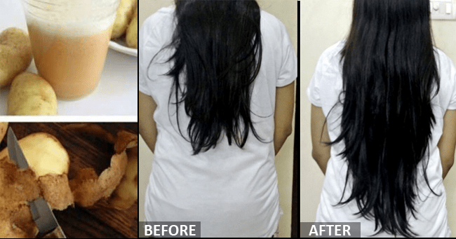Make Your Hair Grow Faster With These 5 Things