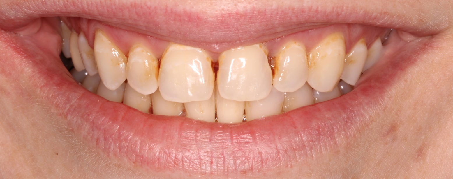 Dentist Kingston PA Your Local Dental Office Brand Dental