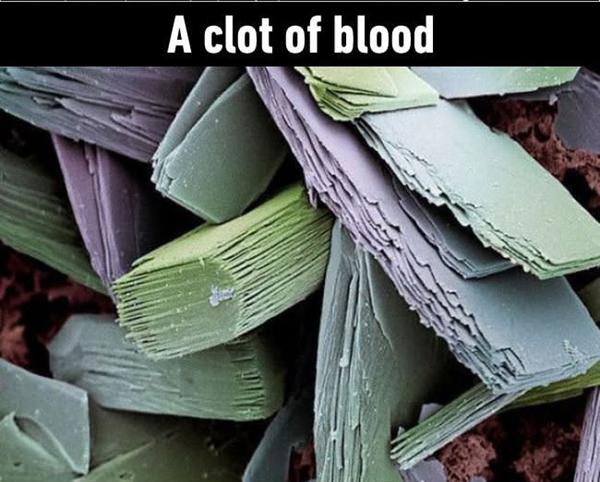 An internet meme is a unique form of media that's spread quickly online, typically via social media. It Is Amazing How These 25 Everyday Things Look Under Microscope