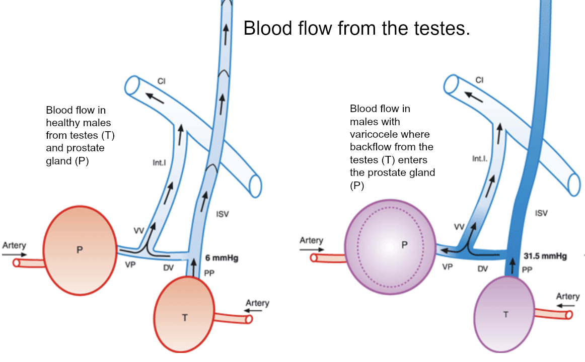 Importance of Vitamin K2 for prostate health (and varicose veins