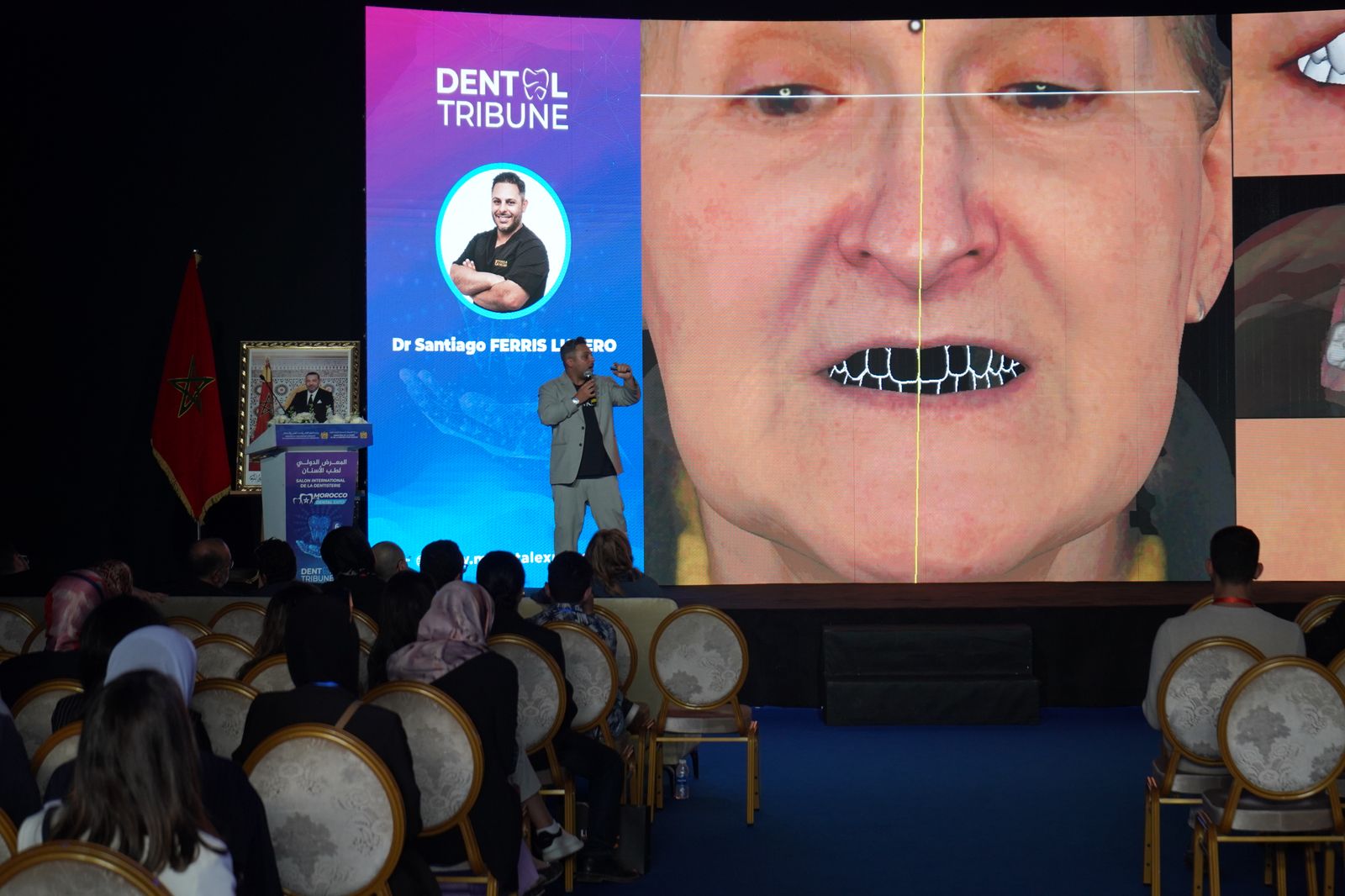 اختتام معرض طب الأسنان بالدار البيضاء بعد تحقيقه لنجاحً غير مسبوق