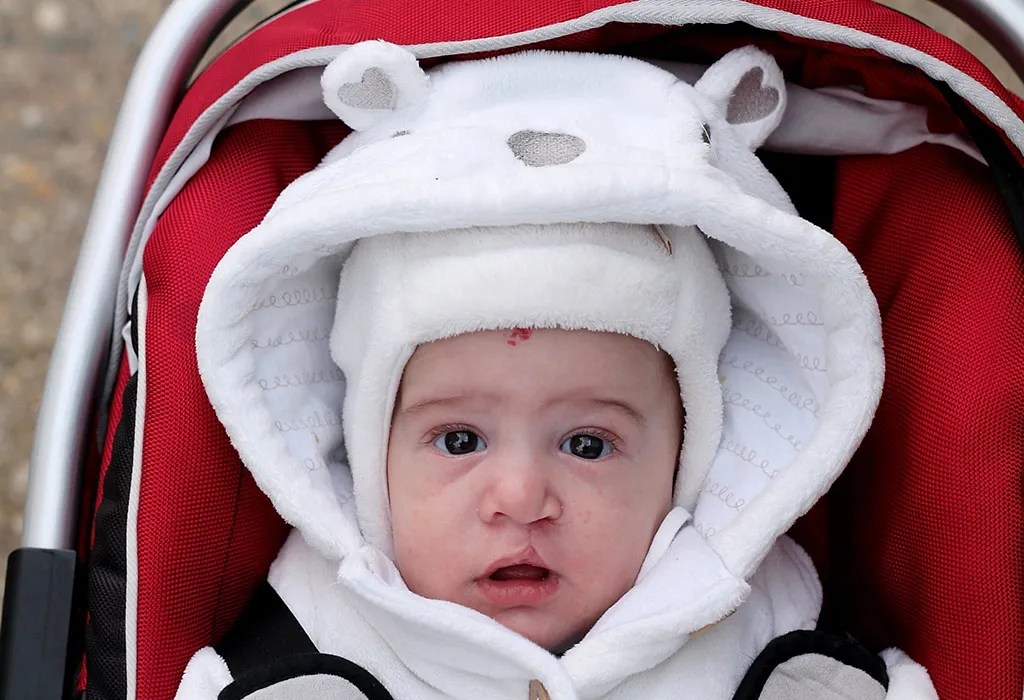 Out of one hundred children born with a cleft palate, sixty of them will be . Cleft Lips And Palate In Babies Reasons Signs Treatment