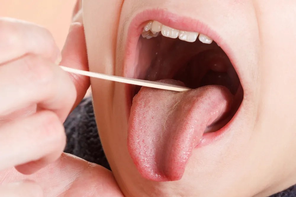Laringitis Kronis: Gejala, Penyebab, Pengobatan | Hello Sehat
