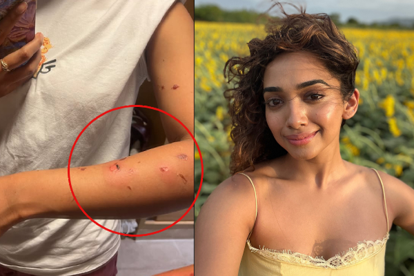 ஷூட்டிங்கில் சூடான எண்ணெயால் நடந்த விபத்து.. நடிகை சான்வே மேக்னாவுக்கு மோசமான காயம் ஷூட்டிங்கில் சூடான எண்ணெயால் நடந்த விபத்து.. நடிகை சான்வே மேக்னாவுக்கு மோசமான காயம்