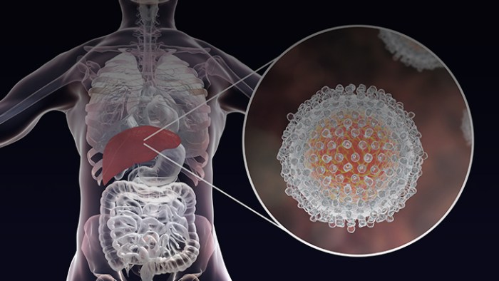 How We Can Help Patients Navigate the Hepatitis C Care Journey Medical ...