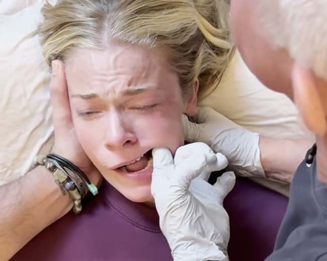 Apa Itu Deep Jaw Release Therapy? Terapi Rahang Viral Redakan Stres dan Nyeri