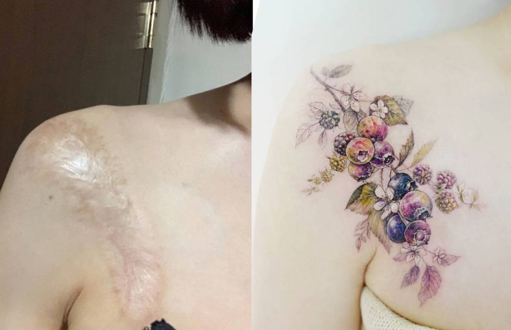 Scar Cover-Up. 646_x_1000_jpg