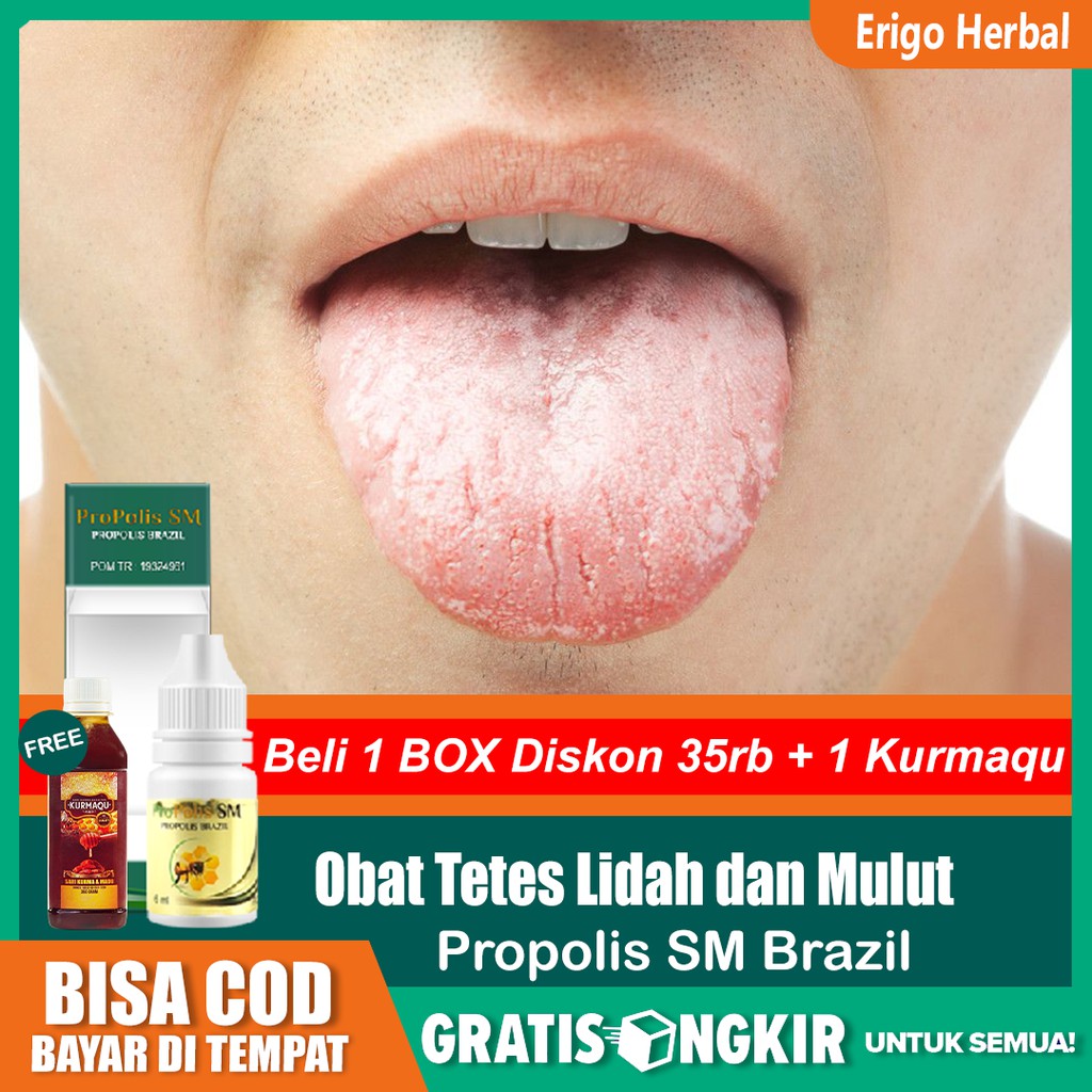 Sikat gigi teratur · 5. Obat Mulut Bau Busuk Tetes Lidah Putih Terasa Pahit Propolis Sm Original Di Surabaya Bisa Cod Shopee Indonesia
