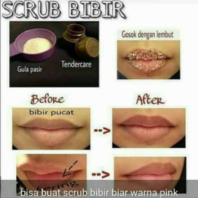 Menjaga kulit bibir tidak kering 2. Tender Care Obat Jerawat Obat Luka Obat Beruntung Pelembab Bibir Base Kosmetik Shopee Indonesia