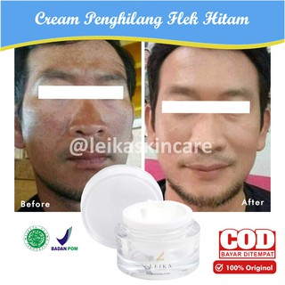 7 cara alami menghilangkan noda hitam pada wajah pria, mudah banget! Jual Ampuh Krim Flek Hitam Membandel Perawatan Wajah Pria Penghilang Bintik Hitam Di Wajah Hasil Maksimal Indonesia Shopee Indonesia