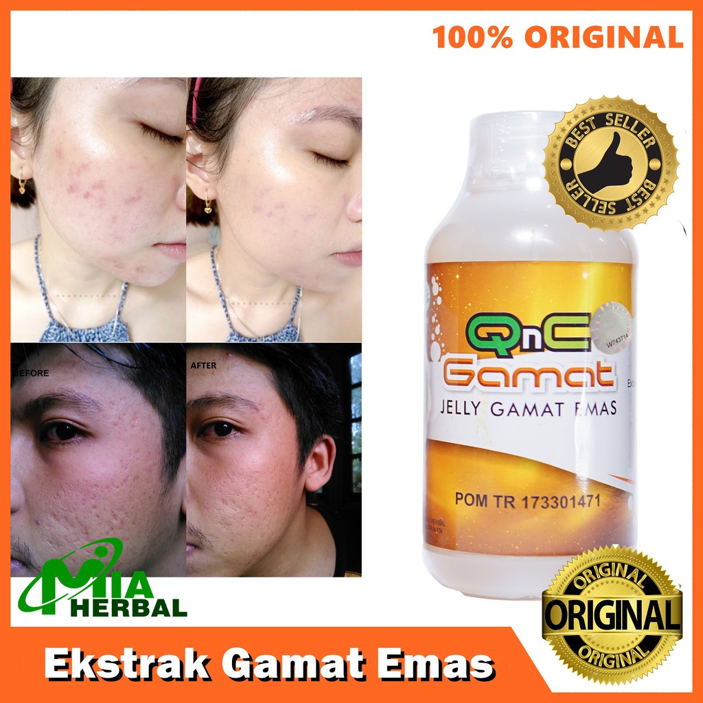 Cek harga terbaik sekarang hanya di biggo! Jual Obat Oles Bopeng Jerawat Eksim Luka Bakar Luka Jahitan Gangren Qnc Jelly Gamat Indonesia Shopee Indonesia