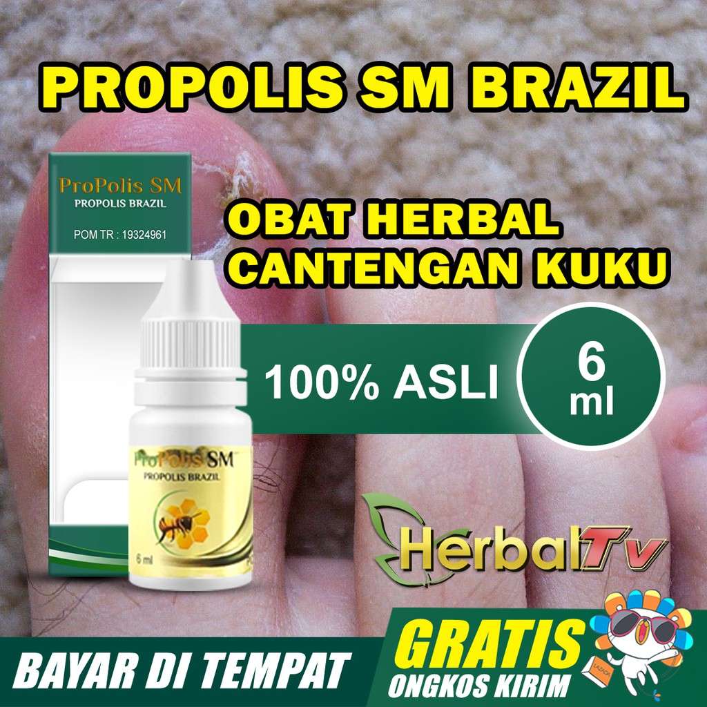 Theresia, biasanya cantengan lebih ampuh diobati dengan operasi kecil. Propolis Obat Cantengan Di Jempol Kaki Cantengan Parah Bengkak Dan Bernanah Paling Laris Di Surabaya Shopee Indonesia