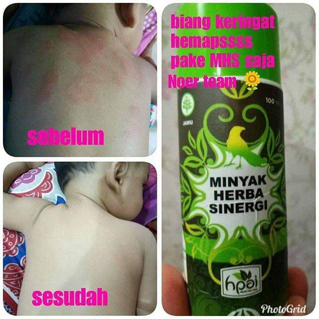 Minyak ini andalan saya banget, khasiatnya banyak. Jual Minyak Herba Sinergi Mhs Indonesia Shopee Indonesia