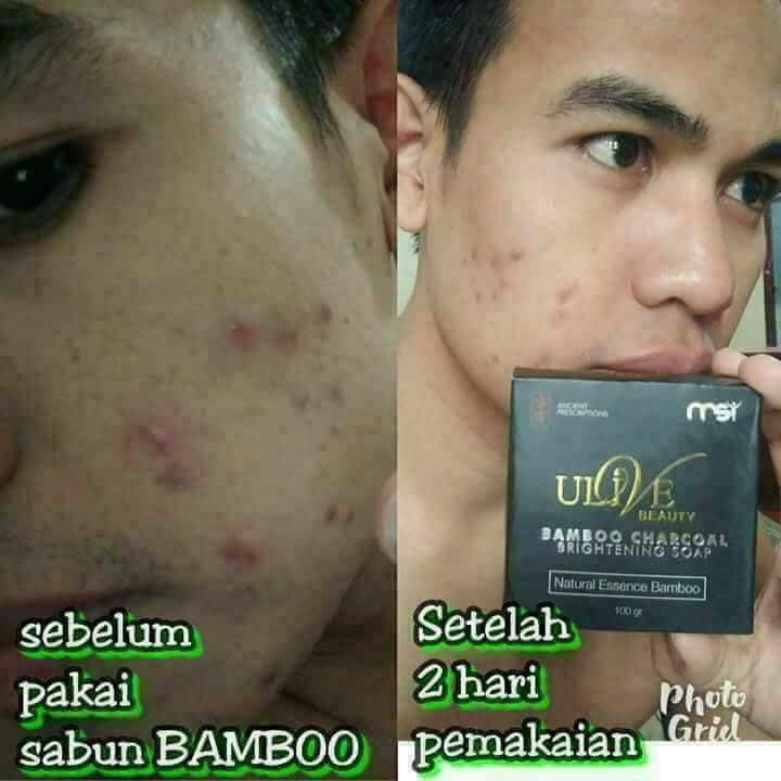 Msi bamboo charcoal ulive beauty sabun collagen diformulasikan dari serbuk arang bambu yang memiliki beragam fungsi bagi kecantikan wajah. Sabun Bamboo Charcoal Produk Msi Ori Obat Jerawat Mengatasi Komedo Shopee Indonesia