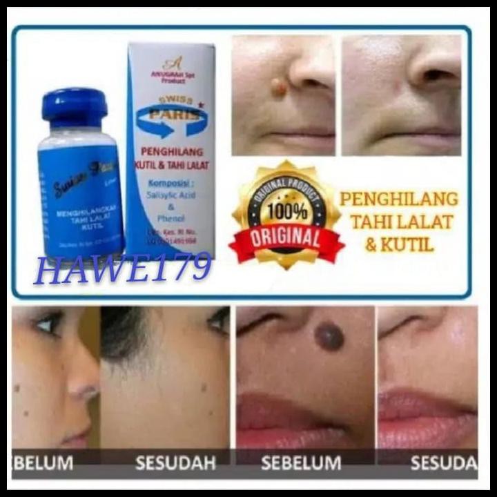Beli obat kutil swiss paris terlengkap harga murah october 2021 di tokopedia! Harga Kutil Swiss Paris Terbaru September 2021 Biggo Indonesia