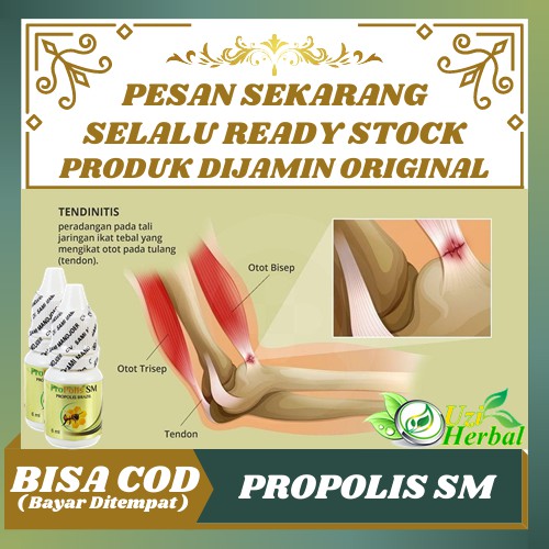 Jual Propolis SM Obat Radang Tendon, Nyeri Tendon, Otot Tendon Robek /  Sobek, Otot Tendon Putus Herbal Indonesia|Shopee Indonesia
